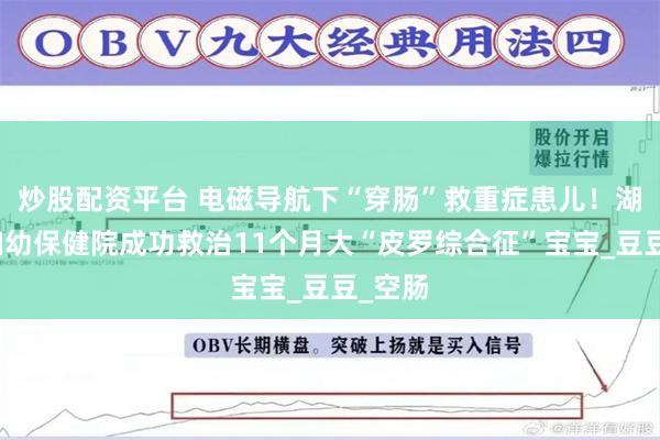 炒股配资平台 电磁导航下“穿肠”救重症患儿！湖北省妇幼保健院成功救治11个月大“皮罗综合征”宝宝_豆豆_空肠